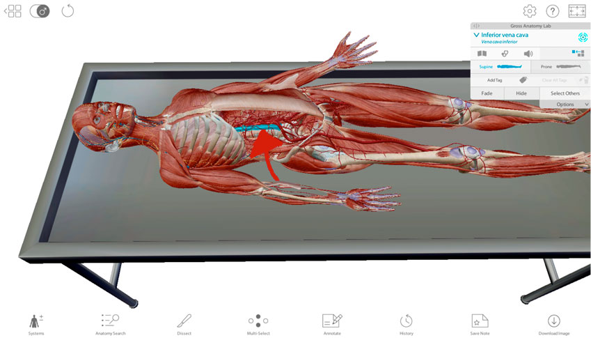 digital cadaver